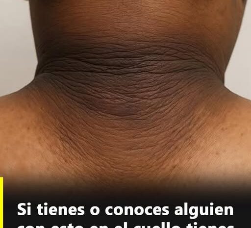 Esto fue lo que descubrió al notar esa extraña marca en su piel…