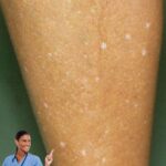 Manchas Blancas en la Piel: ¿Qué Son y Cuándo Preocuparse?