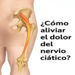 El Nervio Ciático: Alivio Natural a Través de Técnicas y Remedios Conscientes